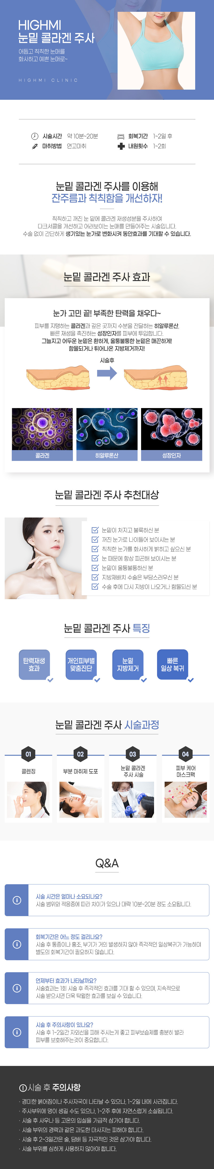비수술 눈밑지방재배치